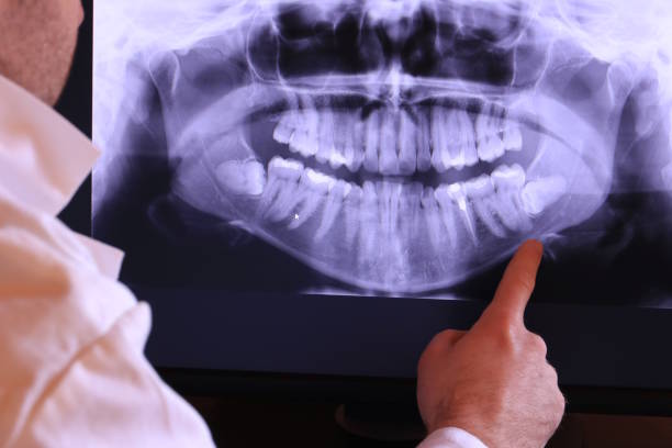 Best 24-Hour Emergency Dentist in Somerville, TX